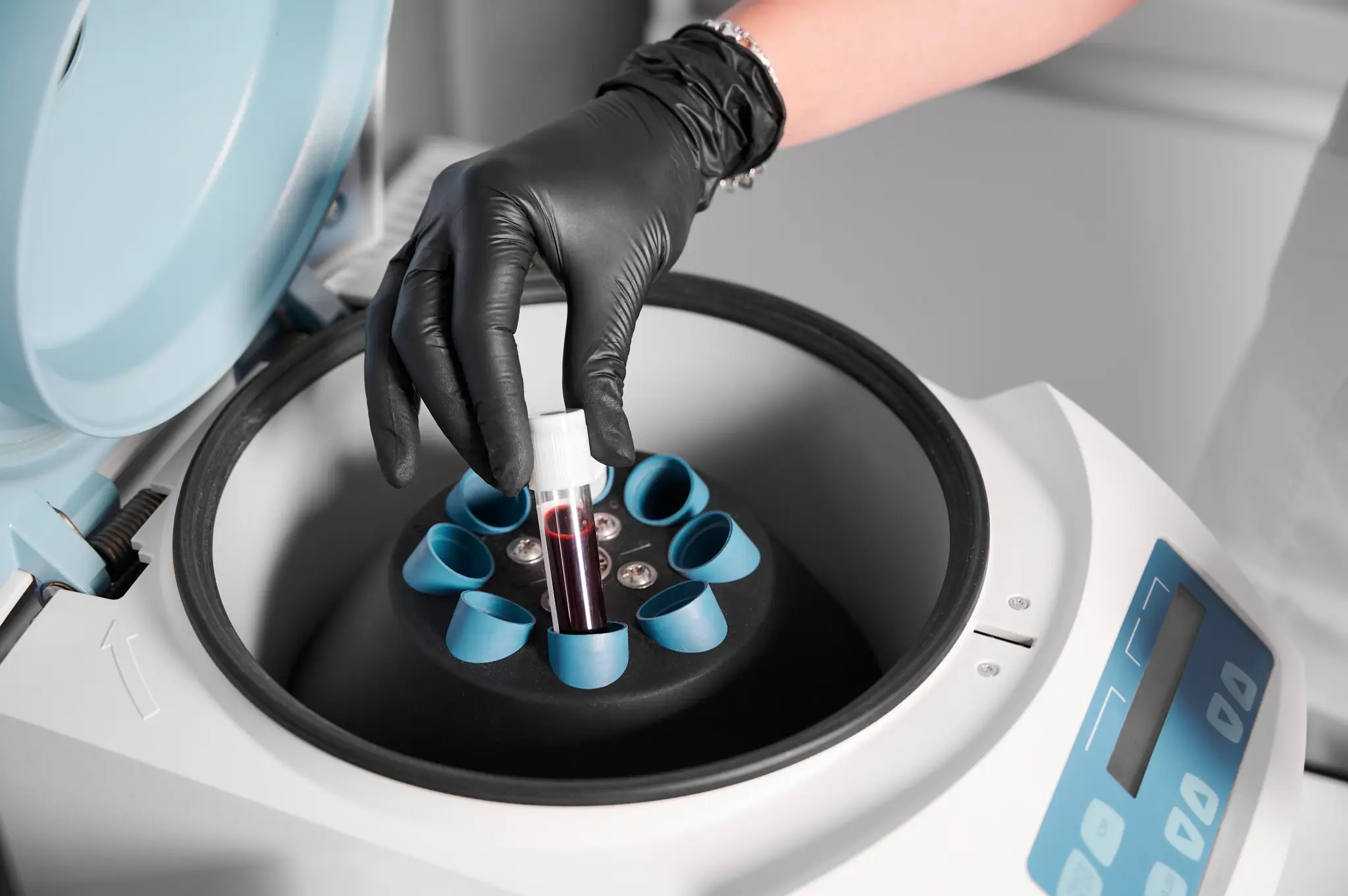 Blood sample being placed in a centrifuge